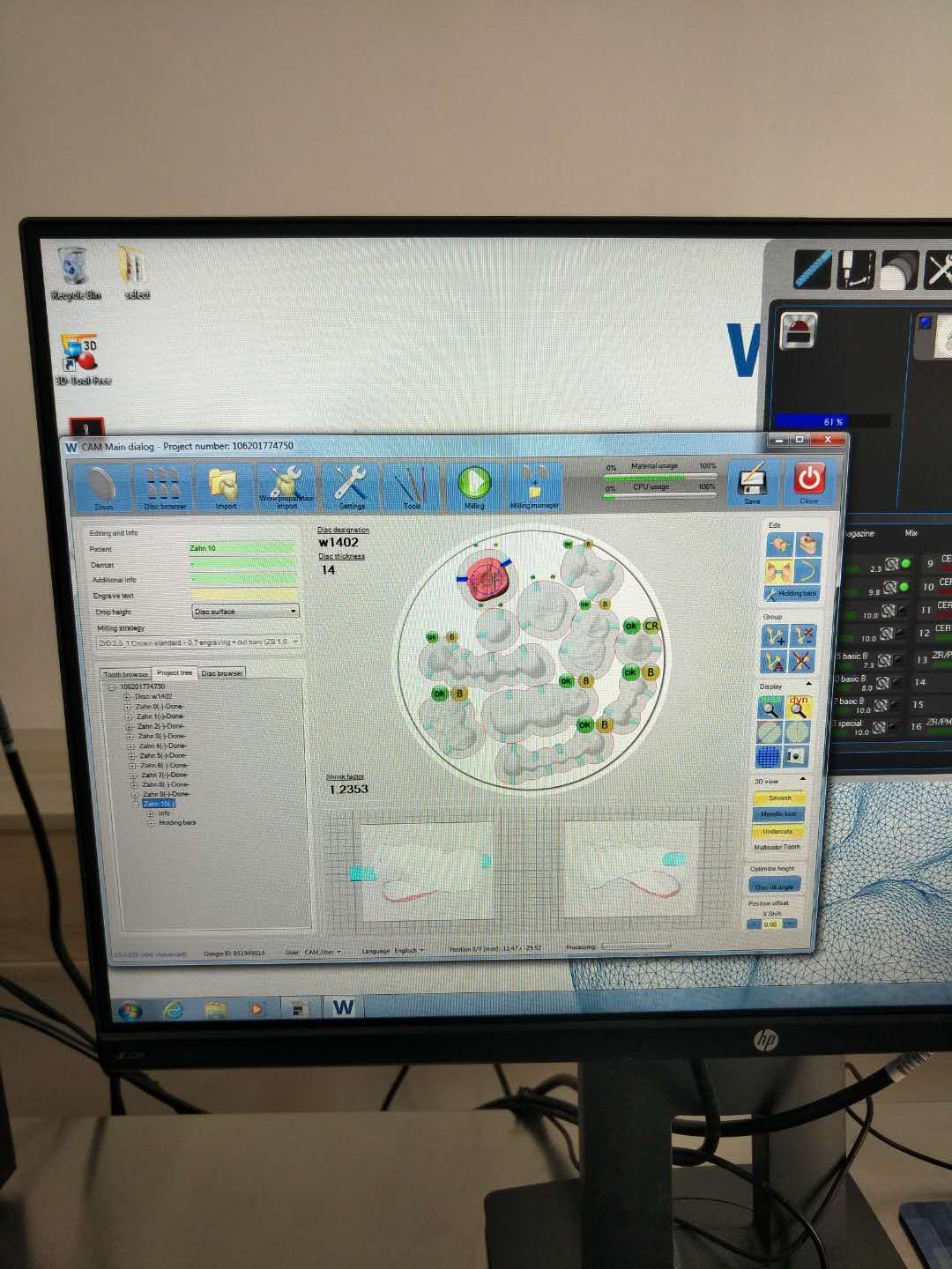 3d打印金属烤瓷制作流程与标准,3d打印氧化锆全瓷牙制作