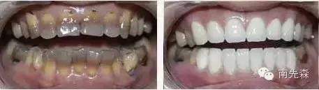 美容冠美白,一周快速脸部美白小妙招