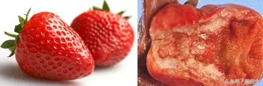 舌尖上的医疗,舌尖上的医疗篇