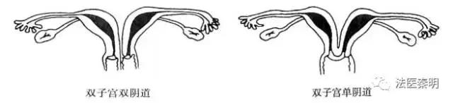 三胞胎的子宫变化,他们是三胞胎姐妹