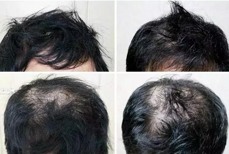 改变发型改变自己好物推荐,发型决定气质好物分享