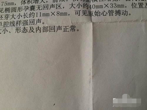 怀孕初期个人经验分享（特别是孕酮低的）