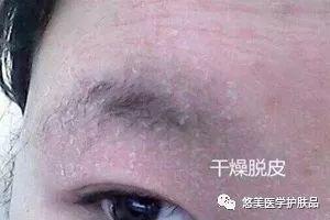 鑸掑┓绁涚棙,鑸掑┓鎶よ偆