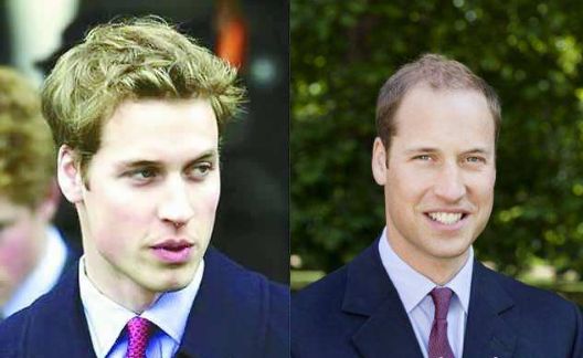 中年男子的「脱发危机」，按按头上的「帽状筋膜」就能好！