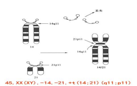 染色体异常的胎儿一定要打掉吗？