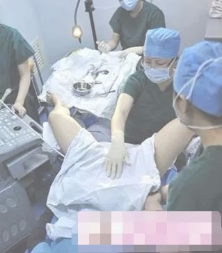 为了老公做试管婴儿值得吗,男人做试管婴儿有多疼