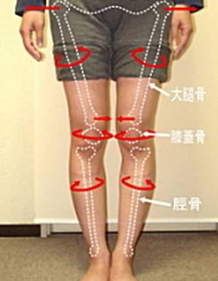 x型腿该如何改善o型腿,o型腿矫正纯干货分享