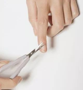 宝宝手起疹子皲裂,宝宝手长倒刺肿了怎么办