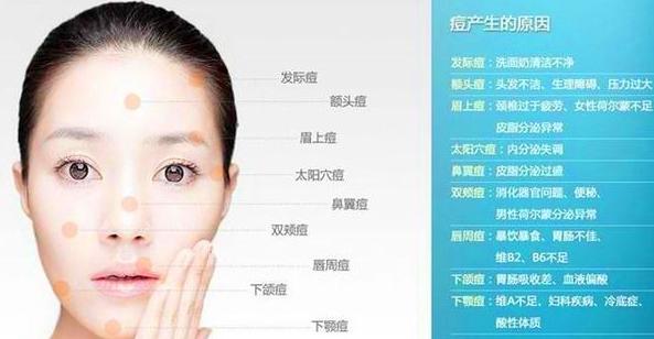 小朋友额头长痘痘怎么办,女儿额头上长痘痘怎么办