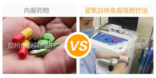 银屑病最好的治疗方法,红皮病型银屑病治疗最好方法