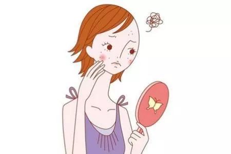 祛痘印正确护肤方式,痘印如何不靠护肤品消除