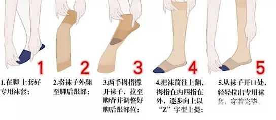 腿上有蚯蚓是什么症状,大腿有蚯蚓怎样治疗