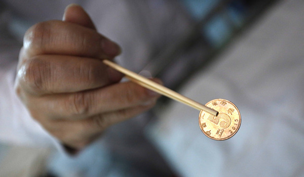 小孩误吞五毛硬币后续,5岁小孩误吞1元硬币到小肠