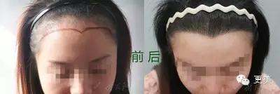 韩式半永久,韩式半永久都有什么