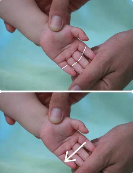 小儿推拿教程带视频的书,小儿推拿止咳化痰手法图解