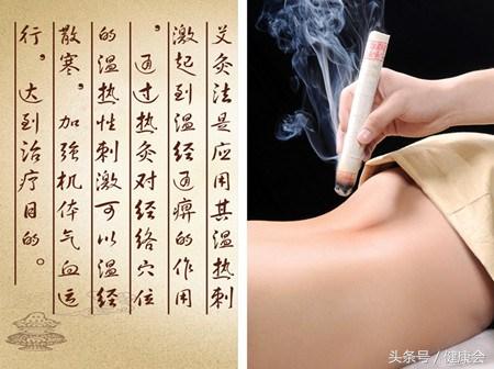 中艾国灸的艾灸反应,艾灸时的各种灸感和排病反应