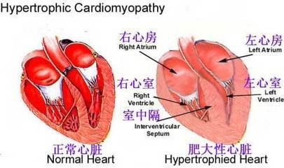 房颤的药物治疗：让快而紊乱的心跳慢下来，跳整齐