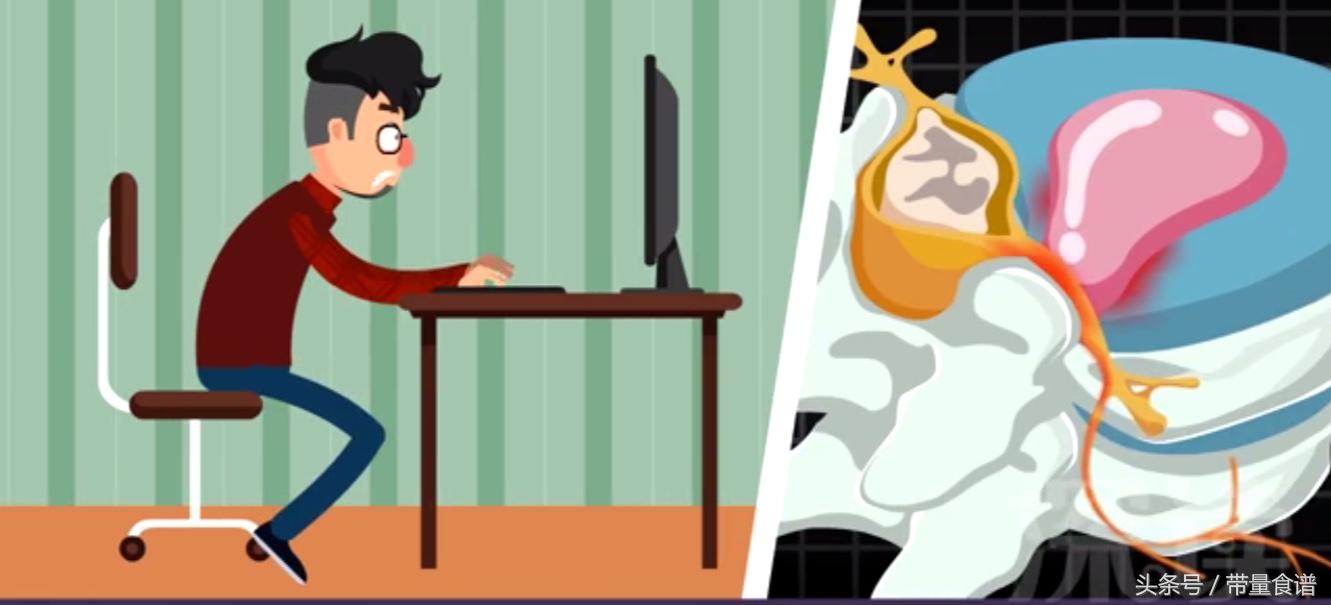 坐不久就腰痛怎么回事,坐着的时候腰椎间盘突出