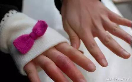 怎样防冻手冻脚,冻手冻脚怎么办最有效的方法