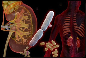 泌尿感染猪苓汤吃几剂,猪苓汤治疗反复尿路感染配方