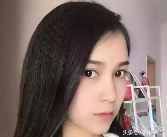 麻药不要敷太厚,眼睛敷麻药过敏