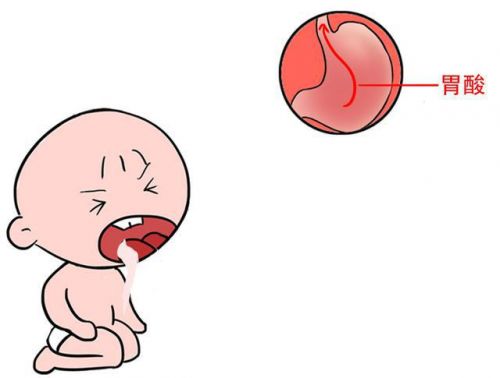 育儿专家宝宝呕吐怎么办,小宝贝恶心吐是怎么回事