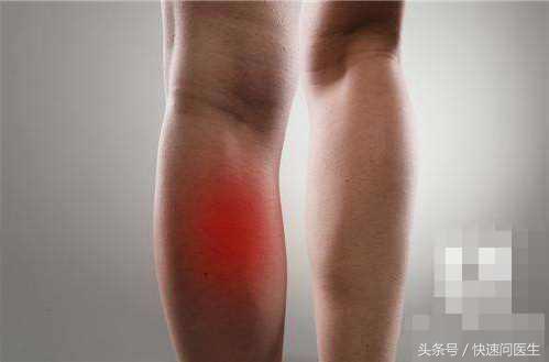 动脉血栓会引起大腿肌肉疼吗,动脉血栓的并发症有哪些