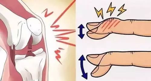 脖子左右摆动咔咔响怎么回事,脖子一转咔咔响