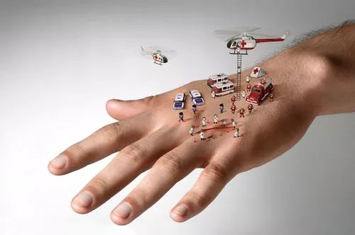 就是这样不起眼的伤口最后要了命