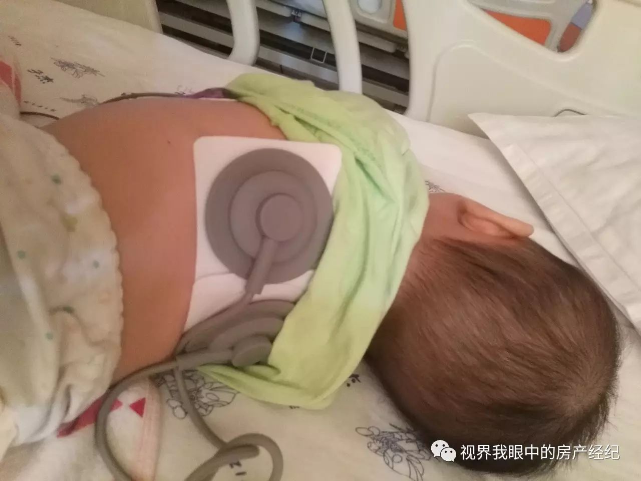 川崎病恢复期怎么预防感冒,川崎病当成感冒会出什么问题