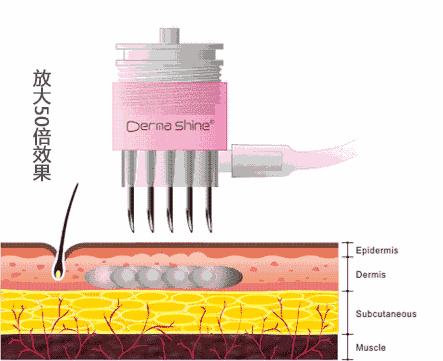 水光针暗访内幕,水光针行业内幕