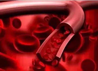 深海鱼油用处到底大不大！致被神话的深海鱼油