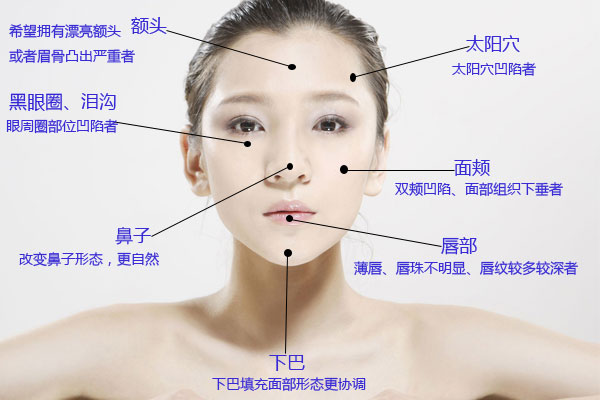 首尔自体脂肪填充,哪些明星做了自体脂肪填充