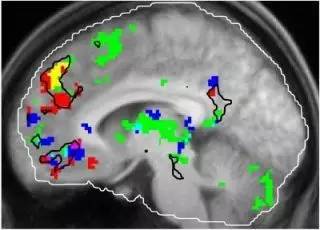 为什么一首歌听多了感觉很奇怪,为什么有些歌听几遍就腻