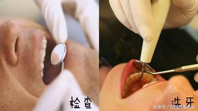 牙齿美白和冷光美白有啥区别,牙齿黄了很多年冷光美白仪有用吗