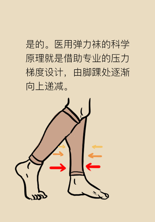 弹力袜对下肢血栓有什么帮助,预防下肢静脉血栓弹力袜注意事项