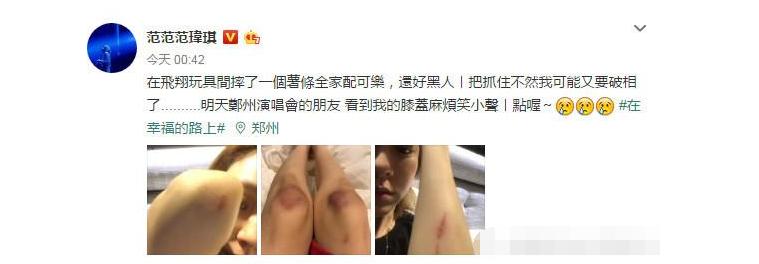 范玮琪受伤的原因,范玮琪受伤事件