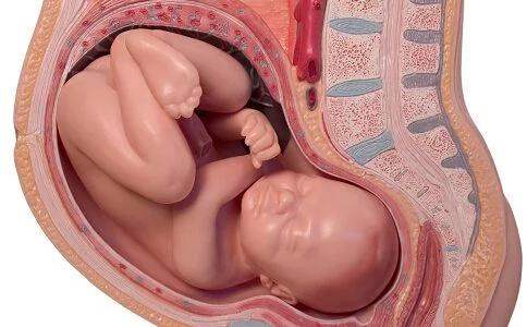 脐带绕颈两周顺产还是剖腹产安全,32周脐带绕颈两周头位