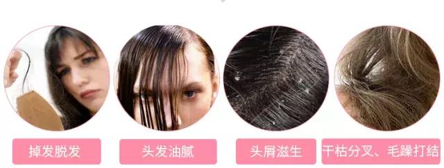 洗发水里面有害成分有哪些,洗发水里有什么成分会导致过敏