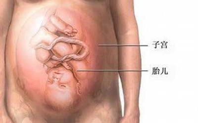 对于选择剖腹产的孕妈妈而言,到底剖腹产是怎样的?(图解)