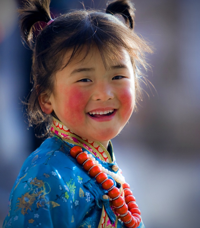 怎样能彻底去除面部红血丝,如何祛除面部红血丝