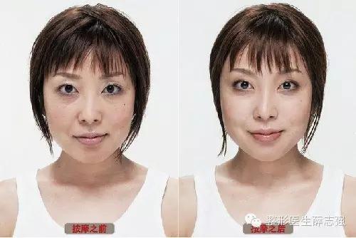 健康科普术后的护理方法,术后养护真的很重要