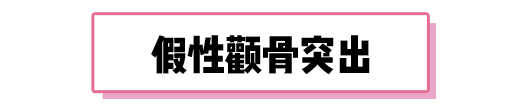 颧骨高填充好还是磨骨,颧骨高自体脂肪填充