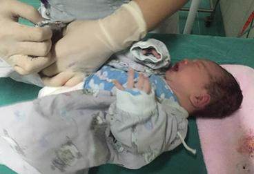 孕晚期不容易脐带绕颈,孕晚期脐带绕颈怎么样才能绕出来