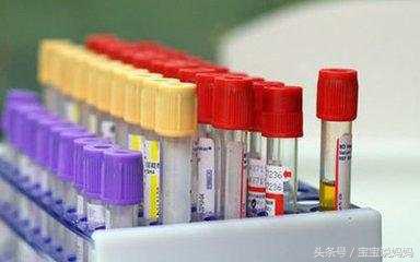 孕妇尿液蛋白质10.3,孕妇尿检蛋白质高是什么原因