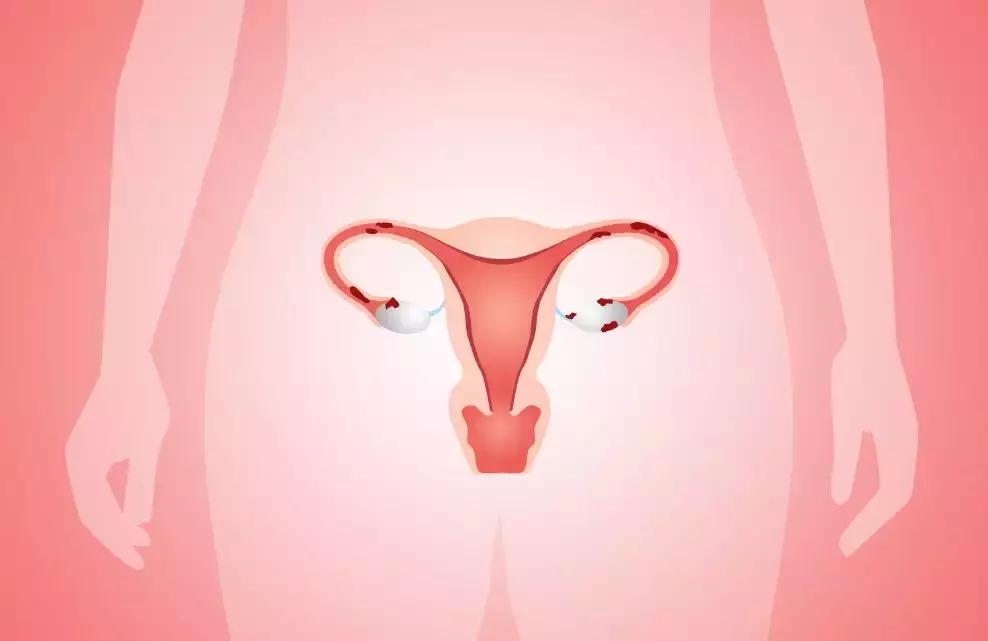 卫生棉真正的用法,卫生棉为什么是黄的