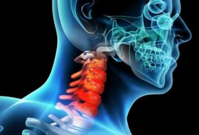 颈椎病中医辨证分型及治疗方法,椎动脉型颈椎病的辨证分型及方剂