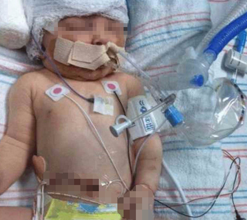 可怜宝妈后悔痛哭，婴儿7天没排过便，肚子胀大发青，医生要截肠