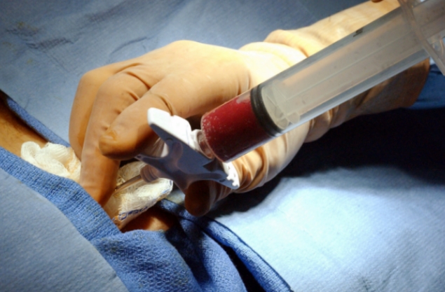 怎么补气血缺铁性贫血,贫血是造血功能有问题吗