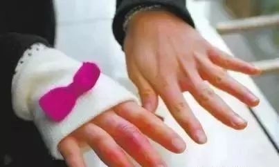 一块钱的红霉素软膏有什么功效,红霉素软膏为啥这么便宜